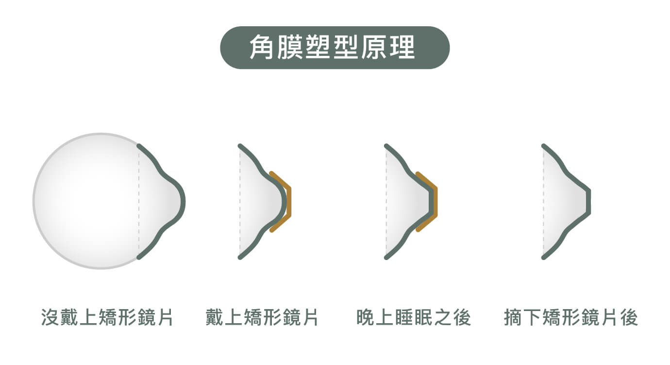 角膜