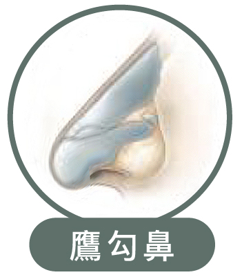 鼻型矯正手術 - 蘇黎世診所.整形外科.醫學美容